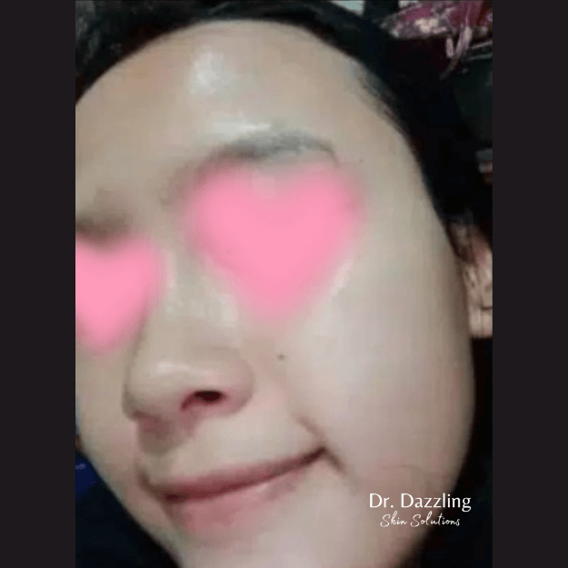 ktre