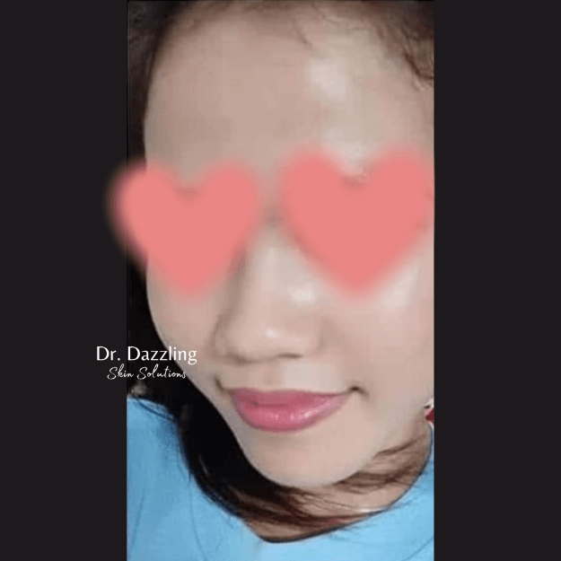 lai