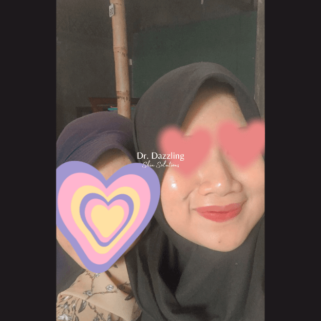 tujtt